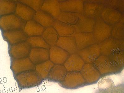 Пукциниаструм пятнистый (Pucciniastrum areolatum)Эций, х400 аммиачный раствор, внутренняя сторона Автор фото: Александр Гибхин