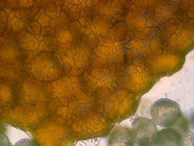 Пукциниаструм пятнистый (Pucciniastrum areolatum)Эций, х400 аммиачный раствор, наружная сторона Автор фото: Александр Гибхин
