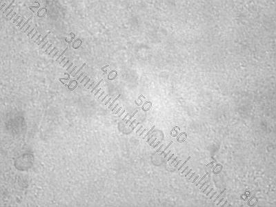 Tremella globisporaспоры, аммиачный раствор, х500 Автор фото: Андрей Смирнов